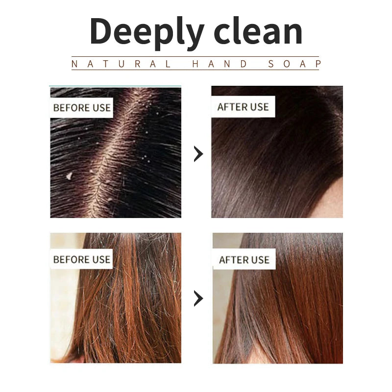 Lavender shampoo is refreshing, oil controlling, and smooth for hair, solving the problem of oily scalp without silicone oil res - Kellylooks Shop