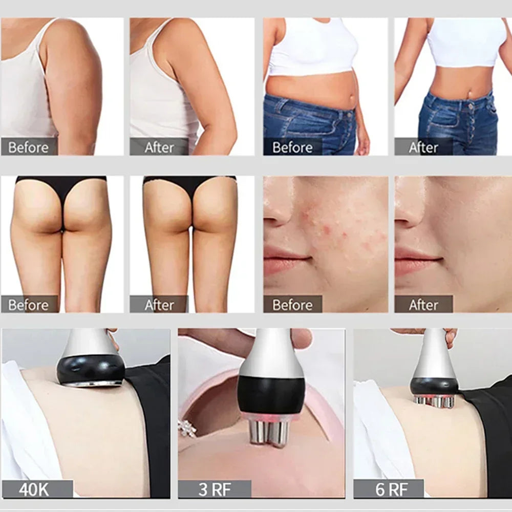 40K Ultrasonic Cavitation Machine radiofrecuencia corporal Facial Lifting Body Slimming Beauty skin Massage Weight Loss Machine