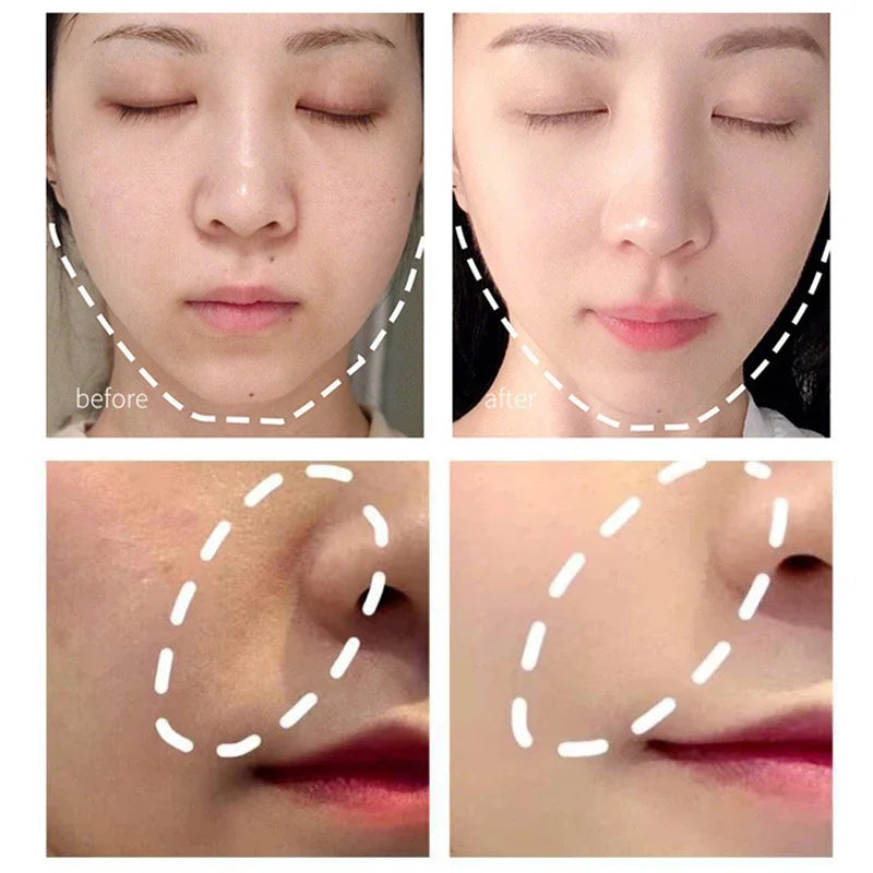 Electric Facial Beauty Devices Face Lifting Anti Wrinkle Facial Eye Massage with Face Cream Introducer Skin Rejuvenation - Kellylooks Shop