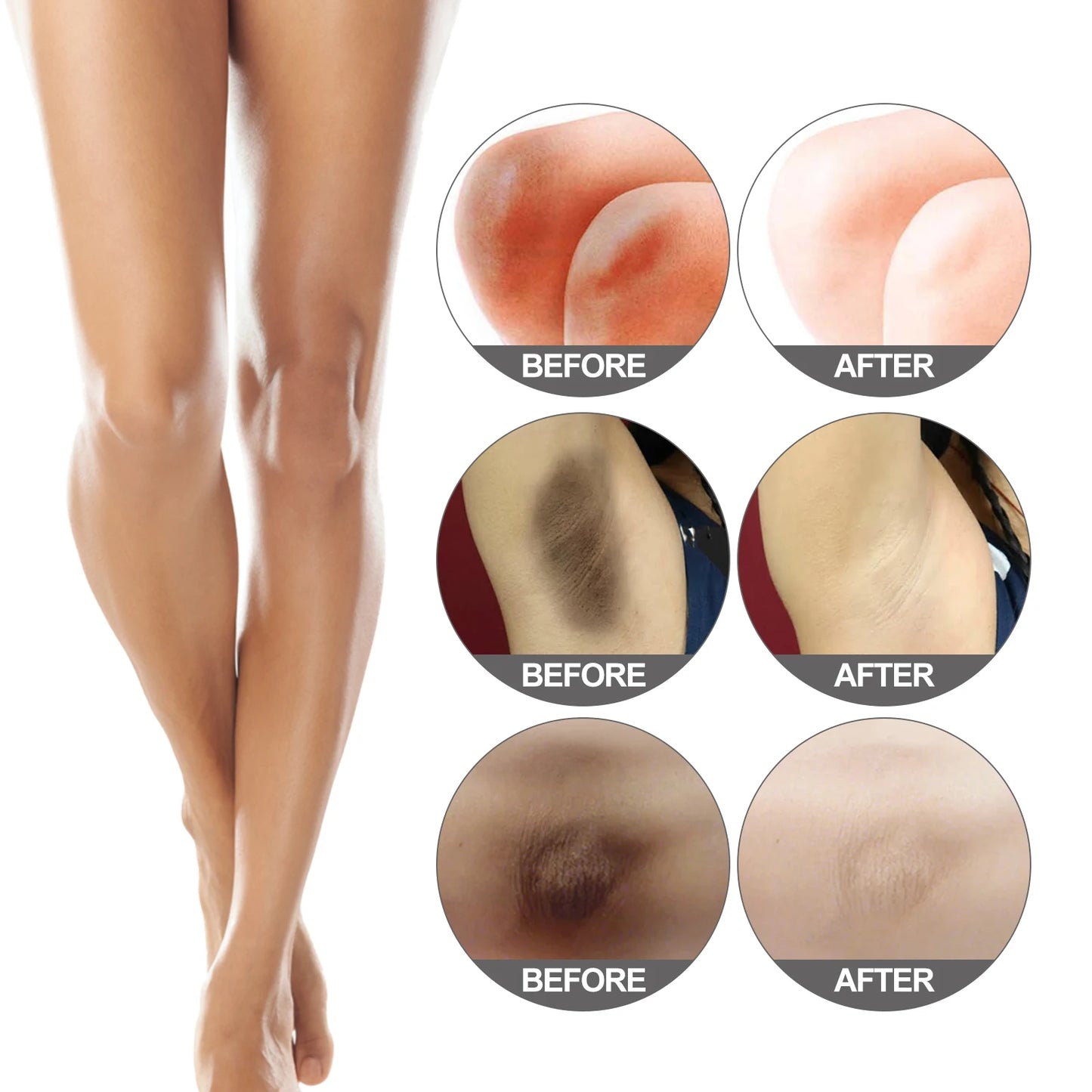 Body Snow Bleach Cream Nicotinamide Removal Dark Spot Melanin Brighten Private Parts Underarm Bleaching Armpit Elbow Knees Joint