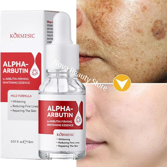 Dark Spots Remover Whitening Serum Face Freckle Melanin Correcting Reduce Fine Lines Brighten Essence Korean Beauty Skin Care - Kellylooks Shop