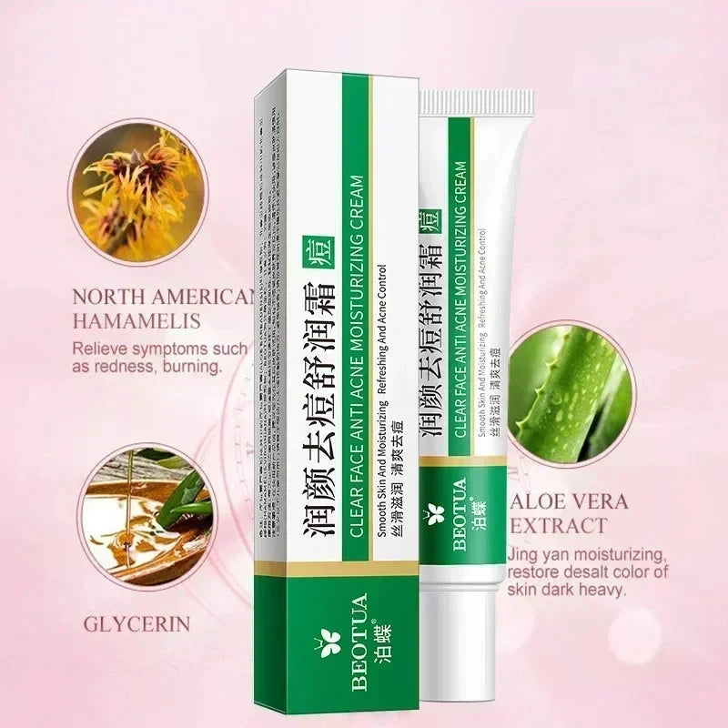Herbal Acne Treatment Cream Face Scar Blackhead Remover Repair Gel Oil Control Shrink Pores Whitening Skin Care Korean Cosmetics - Kellylooks Shop
