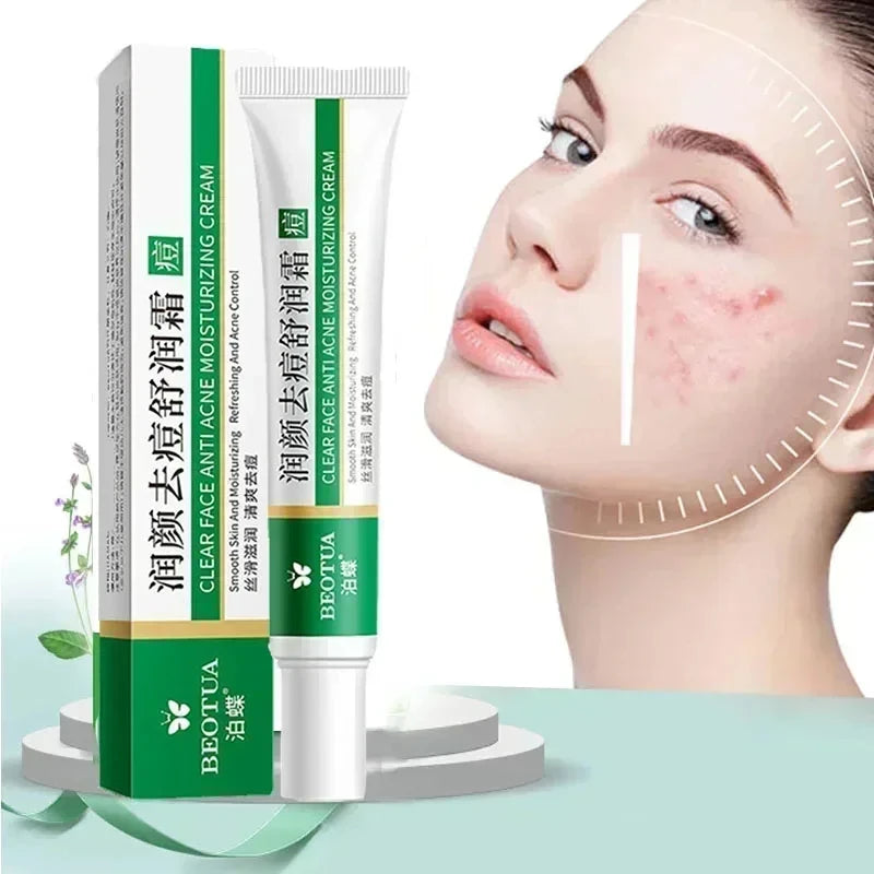 Herbal Acne Treatment Cream Face Scar Blackhead Remover Repair Gel Oil Control Shrink Pores Whitening Skin Care Korean Cosmetics - Kellylooks Shop