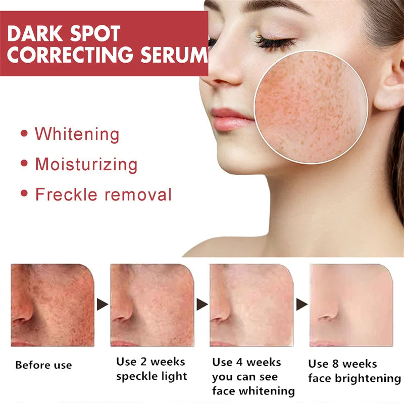 Dark Spots Remover Whitening Serum Face Freckle Melanin Correcting Reduce Fine Lines Brighten Essence Korean Beauty Skin Care - Kellylooks Shop